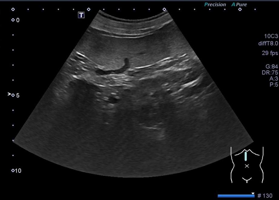 worka/vanillajswheelzoom